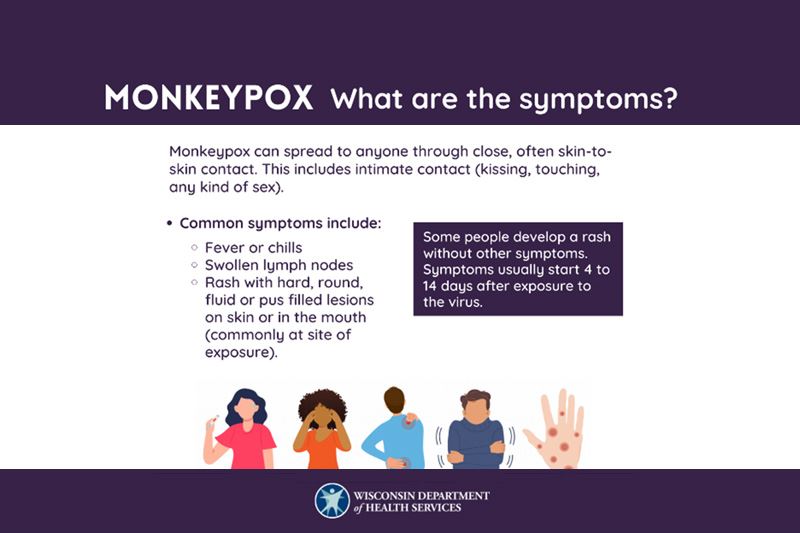Graphic listing monkeypox symptoms. Read the linked post for more information. 